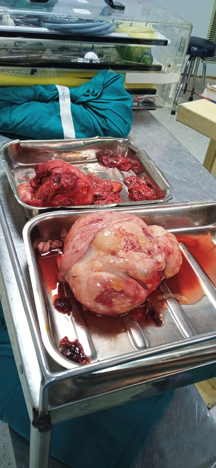 Dr Ekansh Gupta gallery photo 07 | urologist in Rohini Delhi NCR